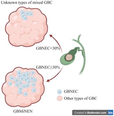 Does the size of the neuroendocrine-carcinoma component determine the prognosis of gallbladder cancer?